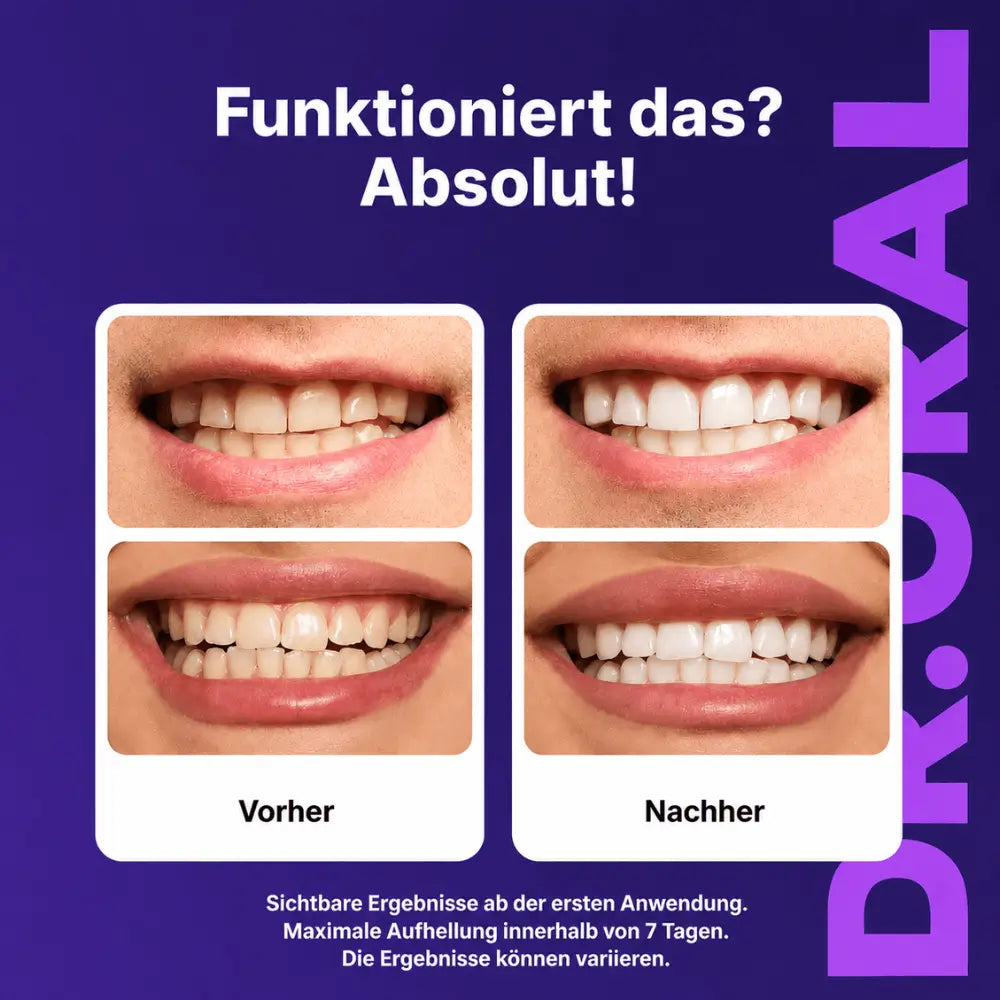 DR. ORAL™  PURPLE WHITENING STRIPS