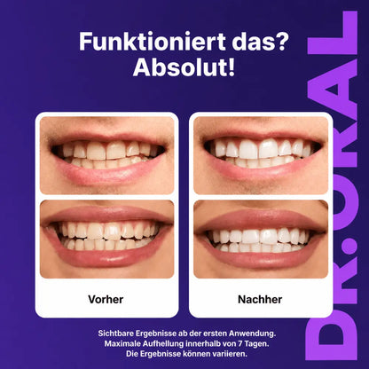DR. ORAL™  PURPLE WHITENING STRIPS